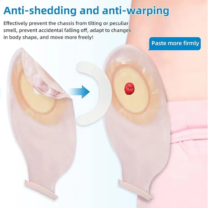 Medical Tape - Tıbbi Ostomi Torbası Güçlendirme Bandı Elastik